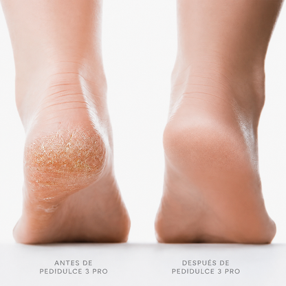 PediDulce 3 Pro